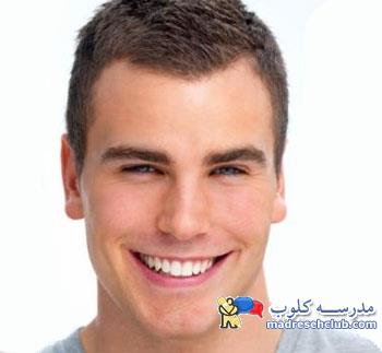 چه روش هایی برای سفید کردن دندان ها وجود دارد؟
